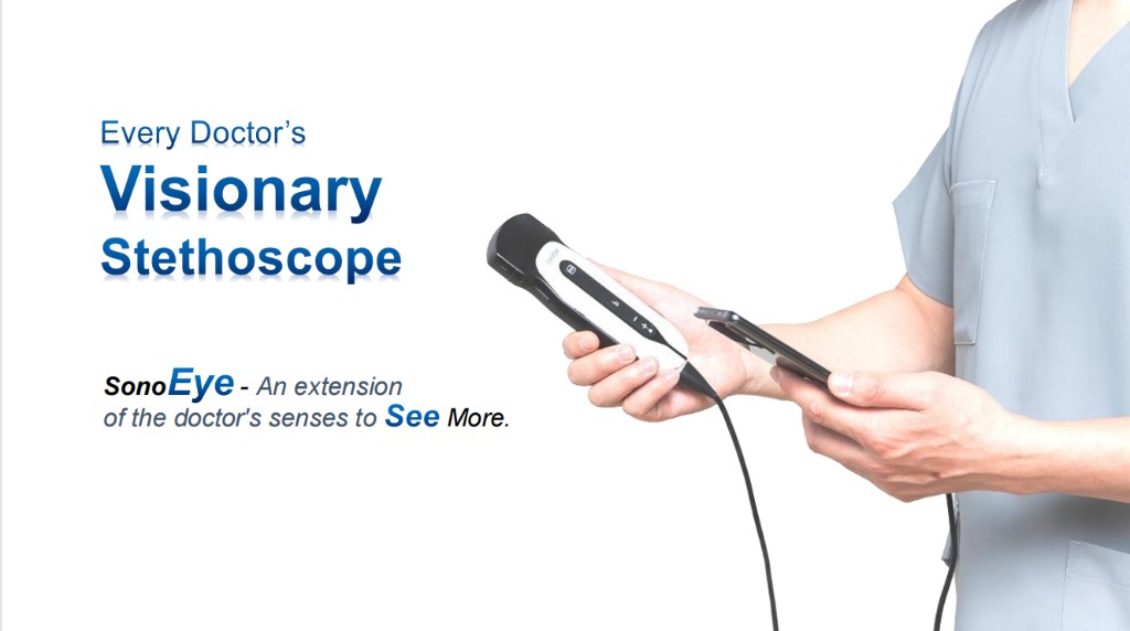 CHISON SonoEye handheld ultrasound probe